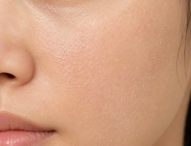 Da thiếu nước và da khô khác nhau thế nào? Giải pháp giúp da phục hồi độ ẩm tự nhiên an toàn và bền vững?